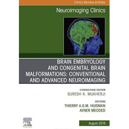 Brain Embryology and the Cause of Congenital Malformations, An Issue of Neuroimaging Clinics of North America