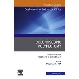 Colonoscopic Polypectomy,...