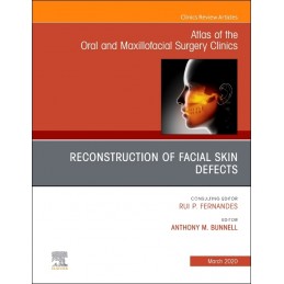 Reconstruction of Facial...