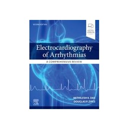 Electrocardiography of Arrhythmias: A Comprehensive Review