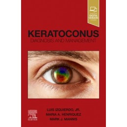 Keratoconus