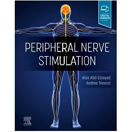 Peripheral Nerve Stimulation