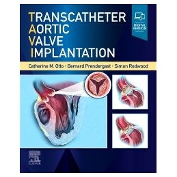 Transcatheter Aortic Valve...