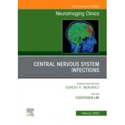 Central Nervous System...