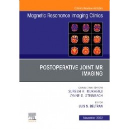 Postoperative Joint MR...