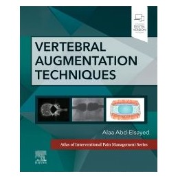 Vertebral Augmentation...