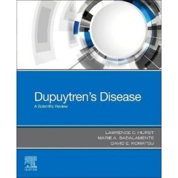 Dupuytren's Disease