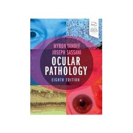 Ocular Pathology