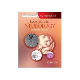 Imaging in Neurology