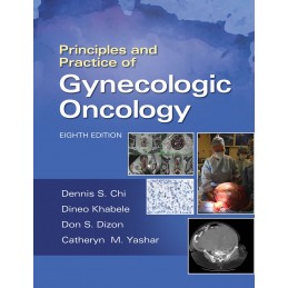 Principles and Practice of Gynecologic Oncology