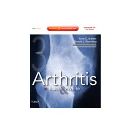 Arthritis in Black and White