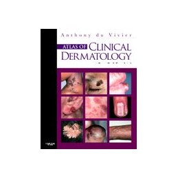 Atlas of Clinical Dermatology