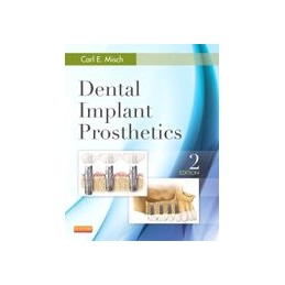 Dental Implant Prosthetics