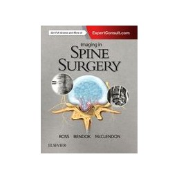 Imaging in Spine Surgery