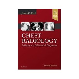 Chest Radiology