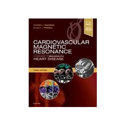 Cardiovascular Magnetic Resonance