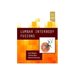 Lumbar Interbody Fusions