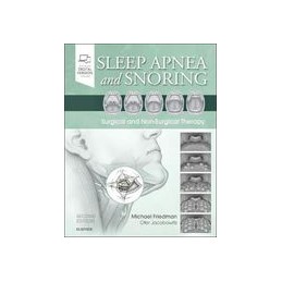 Sleep Apnea and Snoring