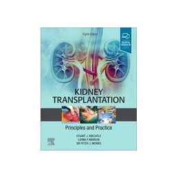 Kidney Transplantation - Principles and Practice