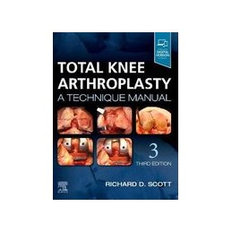 Total Knee Arthroplasty