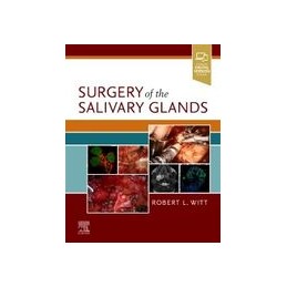 Surgery of the Salivary Glands