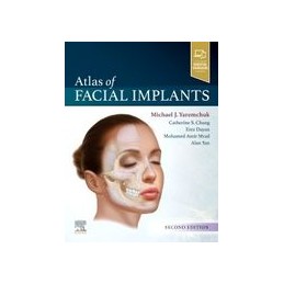 Atlas of Facial Implants