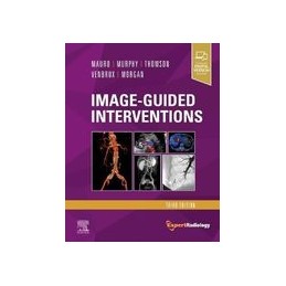 Image-Guided Interventions