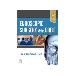 Endoscopic Surgery of the Orbit