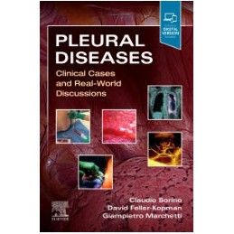 Pleural Diseases