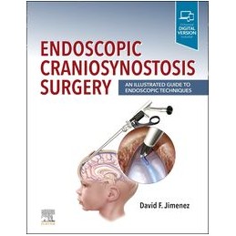 Endoscopic Craniosynostosis...