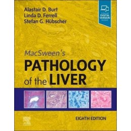 MacSween's Pathology of the Liver