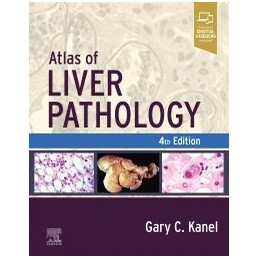 Atlas of Liver Pathology