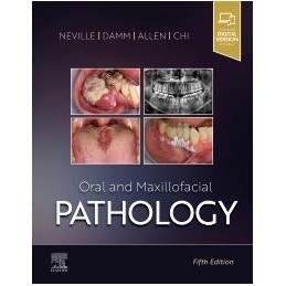 Oral and Maxillofacial Pathology