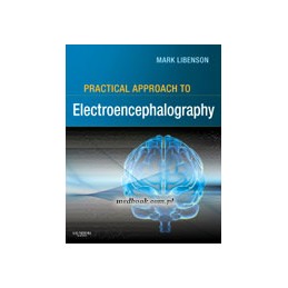 Practical Approach to Electroencephalography