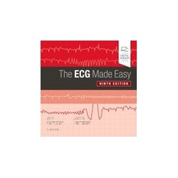 The ECG Made Easy