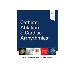 Catheter Ablation of...