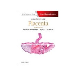 Diagnostic Pathology: Placenta