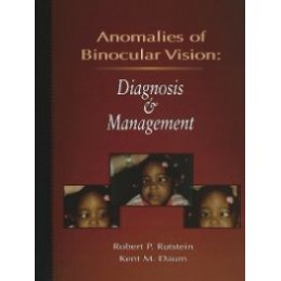 Anomalies Of Binocular Vision