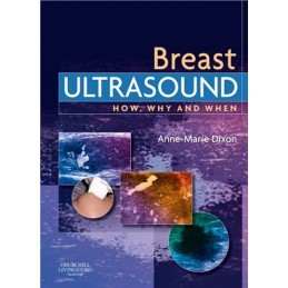 Breast Ultrasound