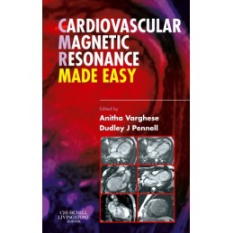 Cardiovascular Magnetic Resonance Made Easy