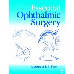 Essential Ophthalmic Surgery