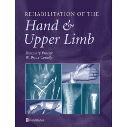 Rehabilitation of the Hand...