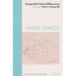 Congenital Hand Differences, An Issue of Hand Clinics