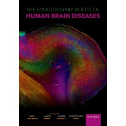 The Evolutionary Roots of Human Brain Diseases