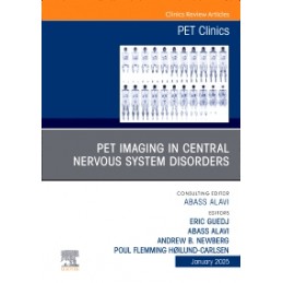 PET Imaging in Central Nervous System Disorders, An Issue of PET Clinics