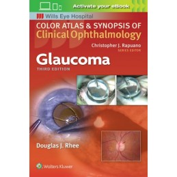 Glaucoma