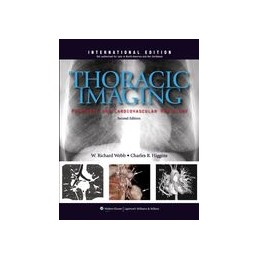 Thoracic Imaging