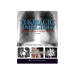 Thoracic Imaging