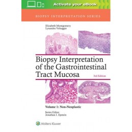 Biopsy Interpretation of...