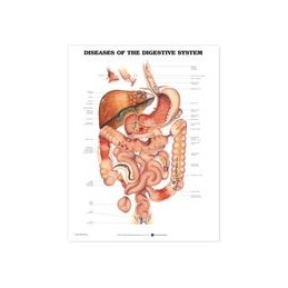 Diseases of the Digestive...